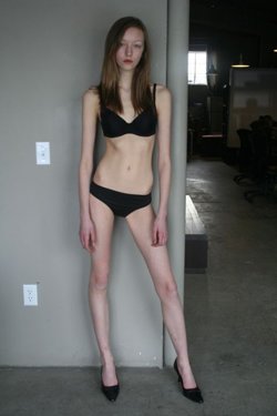 Skinny Model Pics