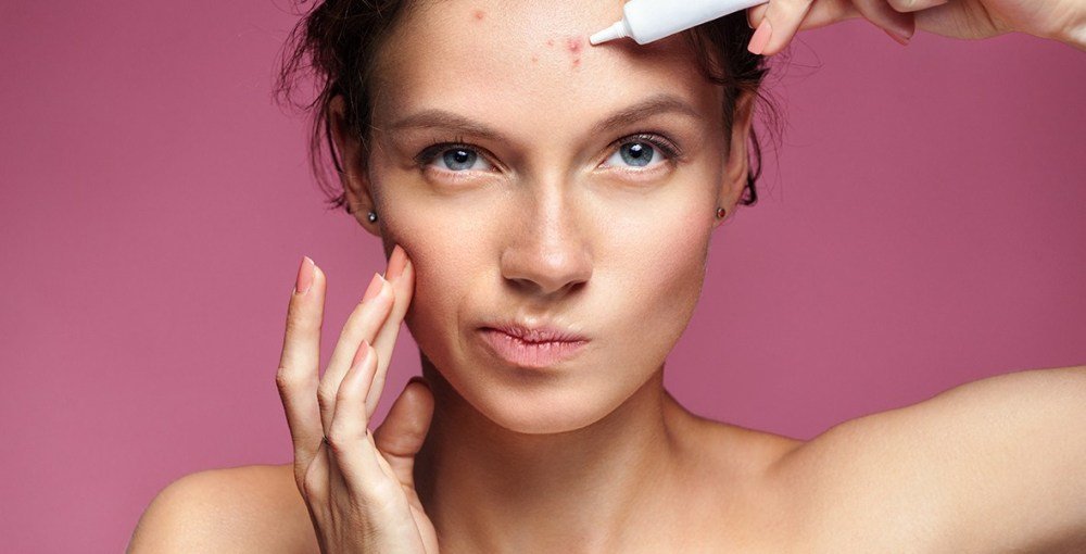 20 Best Pimple Patches to Clear Acne Fast